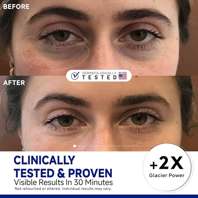 Dr Vincent Peptide Cooling Under Eye Patches, Soothing Eye Patches Instant Reduces Dark Circles and Puffiness, Calming Under Eye Mask with Glacial Water for Bags Treatment, 60 Pairs