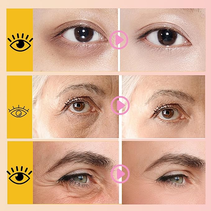 32 Pairs Eye Masks & Lip Masks, 24K Gold Gel Crystal Collagen Eye Patches for Puffy Eyes, MoisturizingLip Mask Pink Lip, Anti-Aging Eye andLip Masks for Reducing Fine Lines & Dark Circles