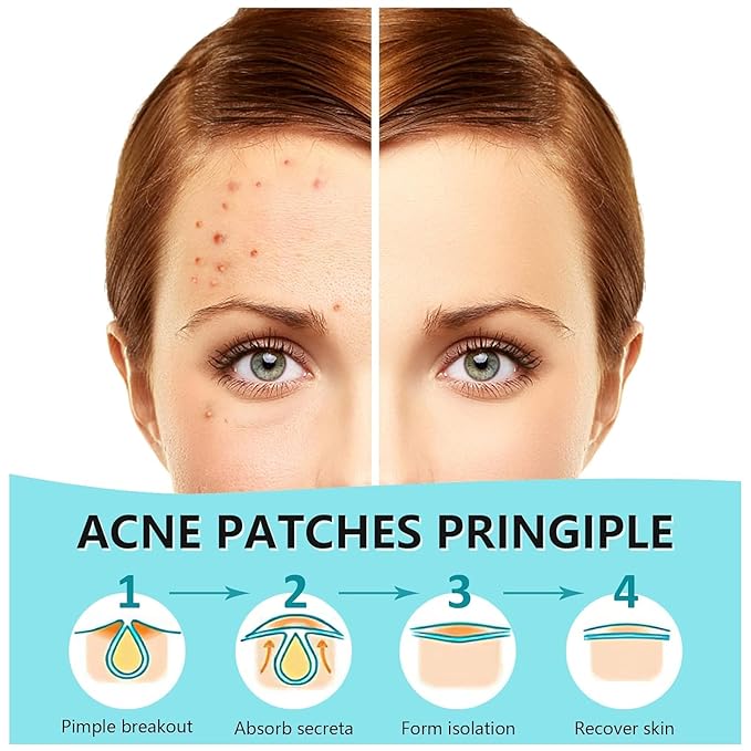 PICcircuit 720 Counts Pimple Patches for Face Hydrocolloid Acne Patches for face Invisible Zit Patches Pimple Patch Acne Spot Treatment Patch Blemish Patches Cover Patches Stickers