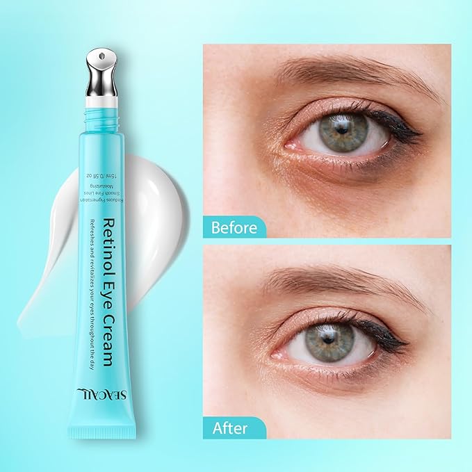 Seacall Retinol Eye Cream - Eye Serum for Dark Circles & Puffiness Anti-Aging - Under Eye Cream with Hyaluronic Acid & Caffeine to Reduce Wrinkles & Repair the Eye Area (15ml)