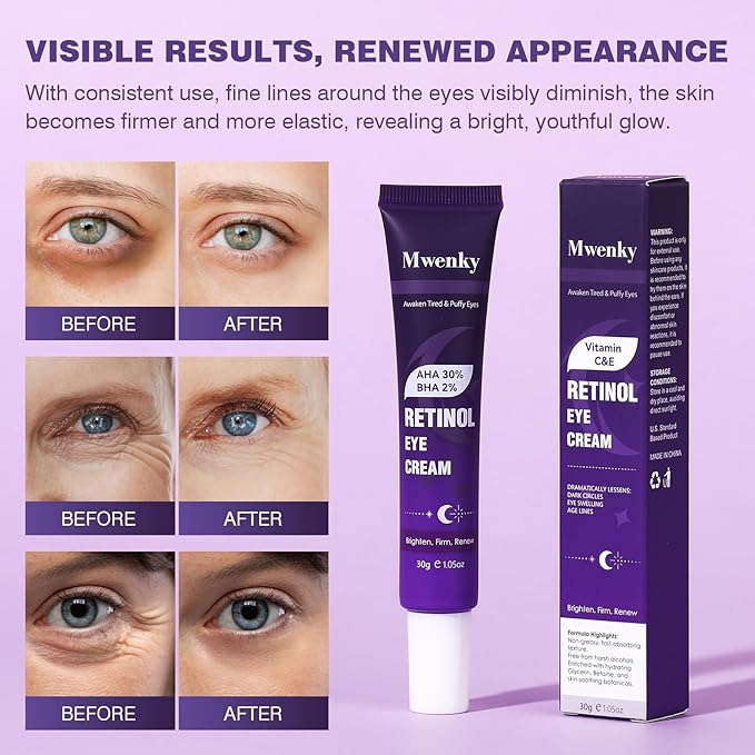 Retinol Eye Cream, Infused with Vitamin C&E to Smooth and Hydrate Skin, Cream for Dark Circles Treatments, Reduce Under, Smooth Wrinkles, Eye Bags, Puffiness