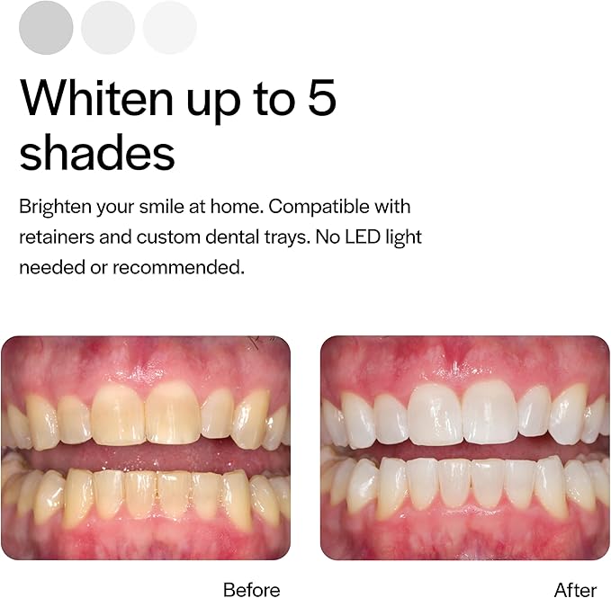 Opalescence 35% CP Mint - Gel Syringes Teeth Whitening - Refill Kit (4 Syringes) Carbamide Peroxide Gel. Made by Ultradent. Tooth Whitening Refill Syringes with Toothbrush. 5197-2tb