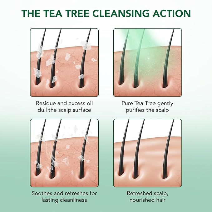 Botanic Hearth Tea Tree Shampoo And Conditioner Set | With 100% Pure Tea Tree Oil, For Itchy And Dry Scalp, Sulfate/Paraben Free | For Men And Women | 16 Fl Oz Each