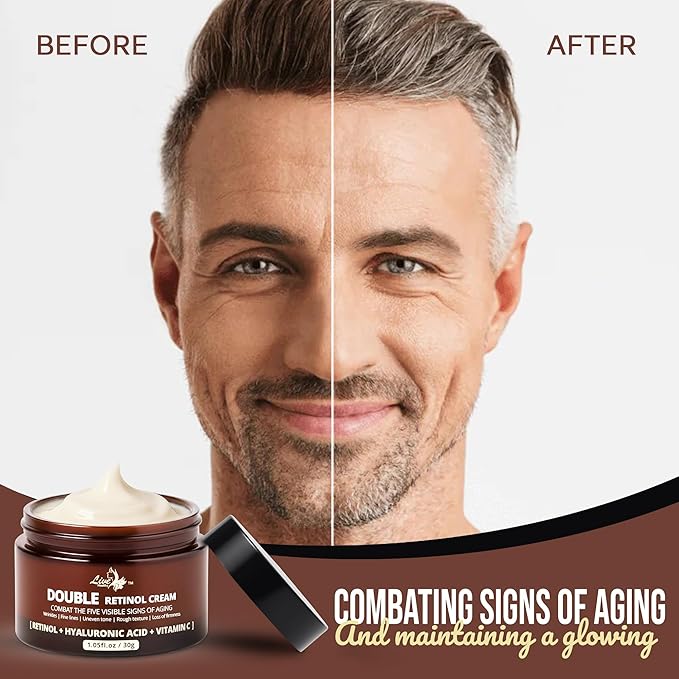 Men’s Double Retinol Face Cream – Reduces Wrinkles, Anti-Aging Moisturizer | Collagen + Hyaluronic Acid + Vitamin E | Fine Lines & Improves Firmness | Eye Bags & Dark Spot Remover | 30g