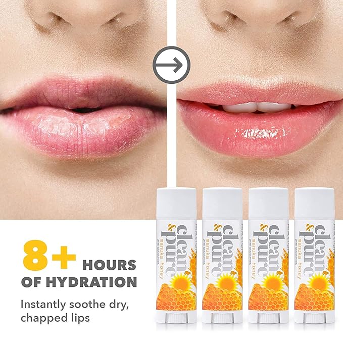 Lip Balm Singles (Manuka Honey Australia…