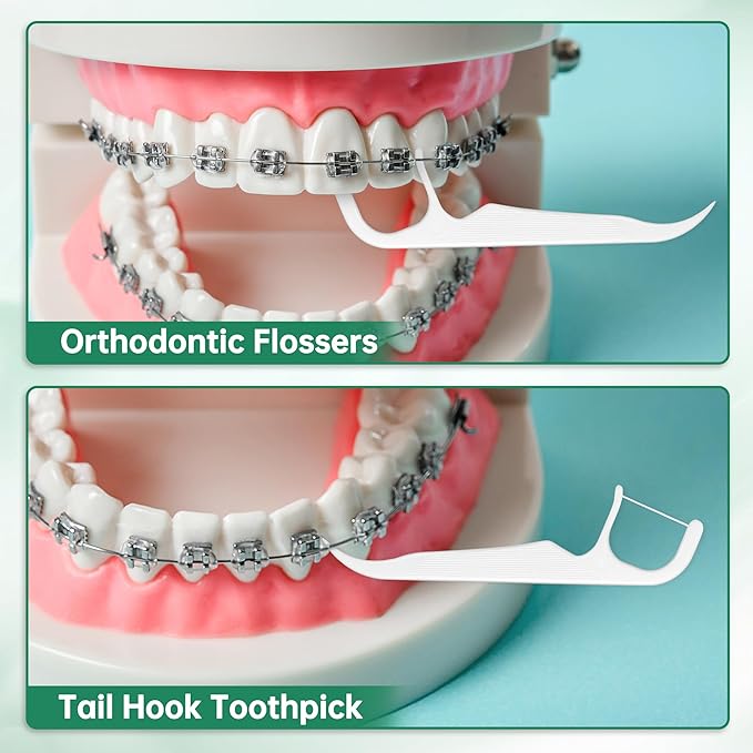 Floss Picks for Braces, 100ct Orthodontic Flossers for Adults and Kids with Toothpick End, Extra Thin Floss Threader for Tight Teeth Cleaning Between Braces, Dental Care Floss Sticks, Mint