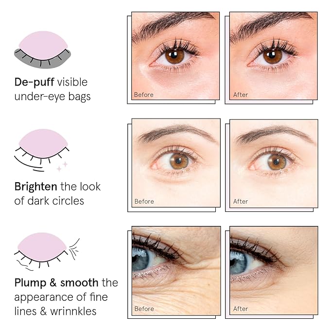 grace & stella Under Eye Patches (12 pairs) Eye Masks for Dark Circles and Puffiness - Valentines Gifts for Sister, Travel & Self Care Gifts, Bachelorette Party Favors - Vegan Cruelty-Free Skin Care