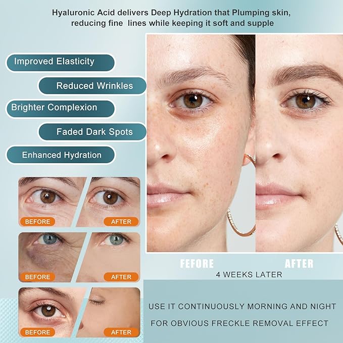 Vitamin C Serum for face, with Hyaluronic Acid & Peptides - Anti Aging Face Serum for Women & Men, Dark Spot Corrector for Firming, Hydrating Treatment to Reduce Wrinkles & Fine Lines, 1 fl oz