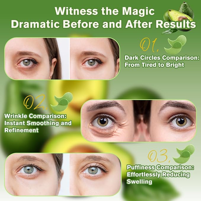 Lktvys Avocado Under Eye Patches (60 PCS), Collagen Eye Mask for Dark Circles and Puffiness, Hydrating Under Eye Pads for Women & Men