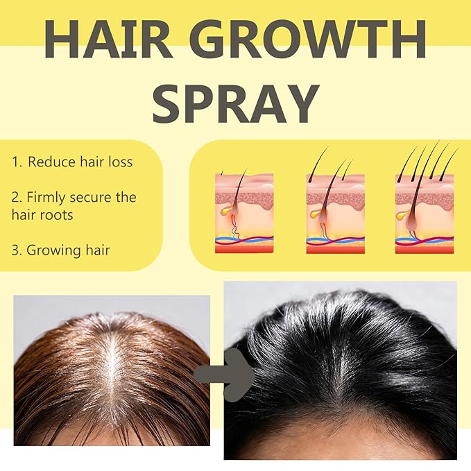 Hair Growth Spray for Women & Men with Rosemary Oil & Biotin - Help Reduce Hair Thinning & Hair Loss for Healthier-Looking Hair - Non-Greasy Fast Absorbing Scalp Spray - 60ml (01)