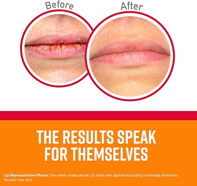 O'Keeffe's Medicated Lip Repair Seal &