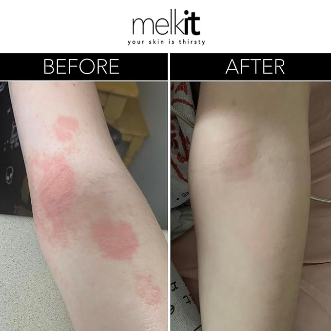 Melkit Body Melk Natural Body Cream - All Over Fast-Absorbing Hydration for Dry or Sensitive Skin - Soothe Sensitive Skin, Rash & Irritation - All Skin Types - 16 oz