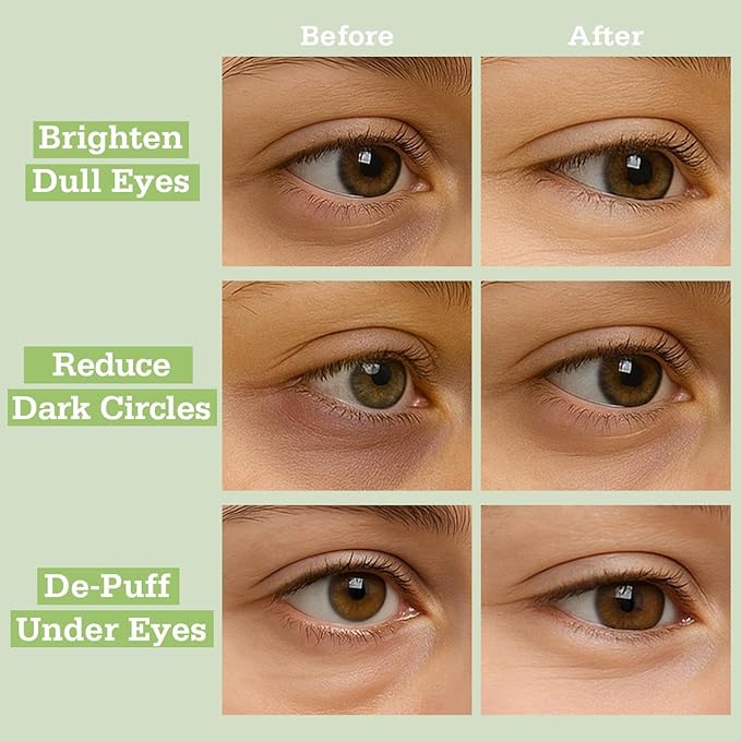 Tintark Matcha Hydrogel Under Eye Patches 28 Pairs Antioxidant Green Tea Eye Mask for Puffy Eyes and Dark Circles 5 Minute Cooling Hydration Under Eye Treatment Ophthalmologist Tested