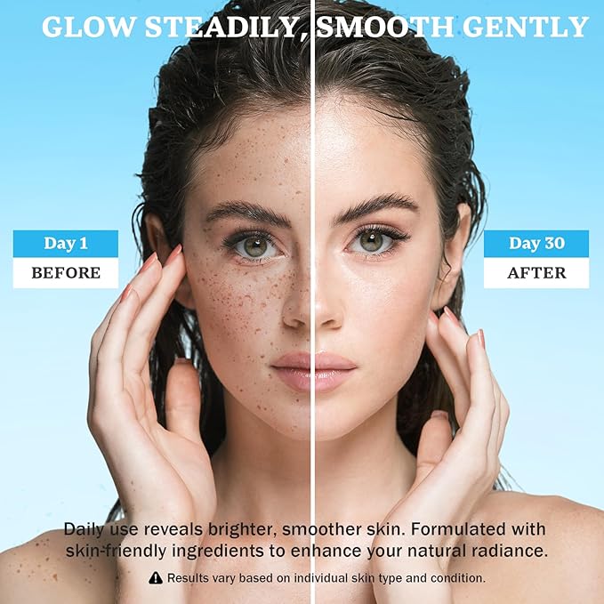 Dark Spot Remover for Face and Body: Dark Spot Corrector Cream, Melasma, Freckle, Sun Spot, Age Spot Remover with Niacinamide and Vitamin C - 1.7 Fl Oz