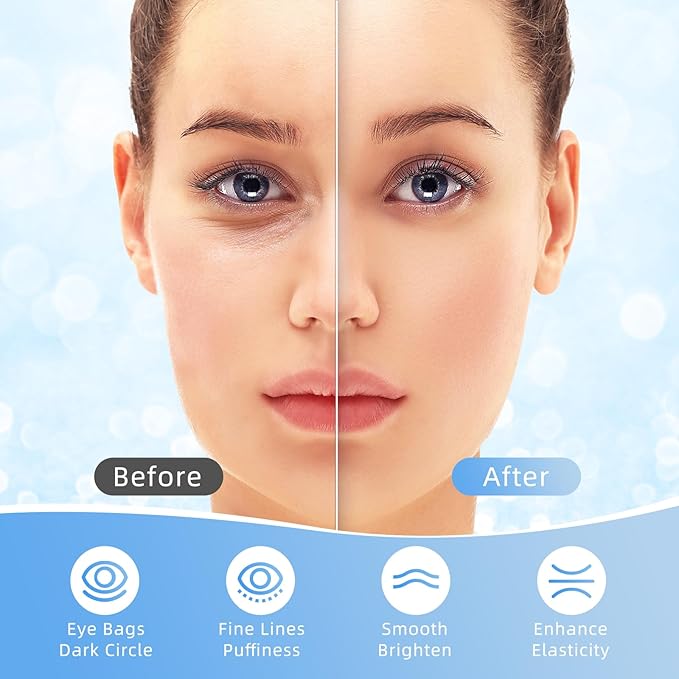 USTELIR Under Eye Patches, 40 Pairs Eye Mask for Dark Circles, Puffy Eyes, Undereye Bags,Wrinkles,Eye Mask Patches with Hyaluronic Acid, Eye Treatment Skin Care for Men & Women Gift