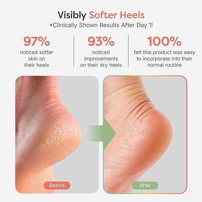 ZenToes Moisturizing Socks for Cracked Heel Treatment, Vitamin E, Olive Oil and Jojoba Oil Infused Heel Socks, Galentines Day Gifts, Self Care Gifts for Women (Fuzzy Black, Wide Width)