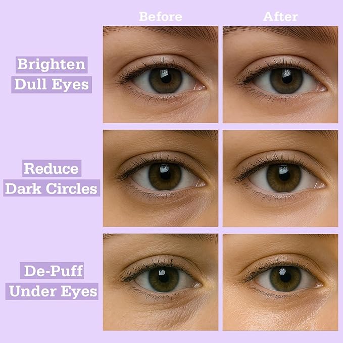 Tintark Lavender Hydrogel Under Eye Patches 28 Pairs 5 Minute Calming Hydrating Eye Mask for Puffy Eyes and Dark Circles Relaxing Cooling Under Eye Pads Ophthalmologist Tested