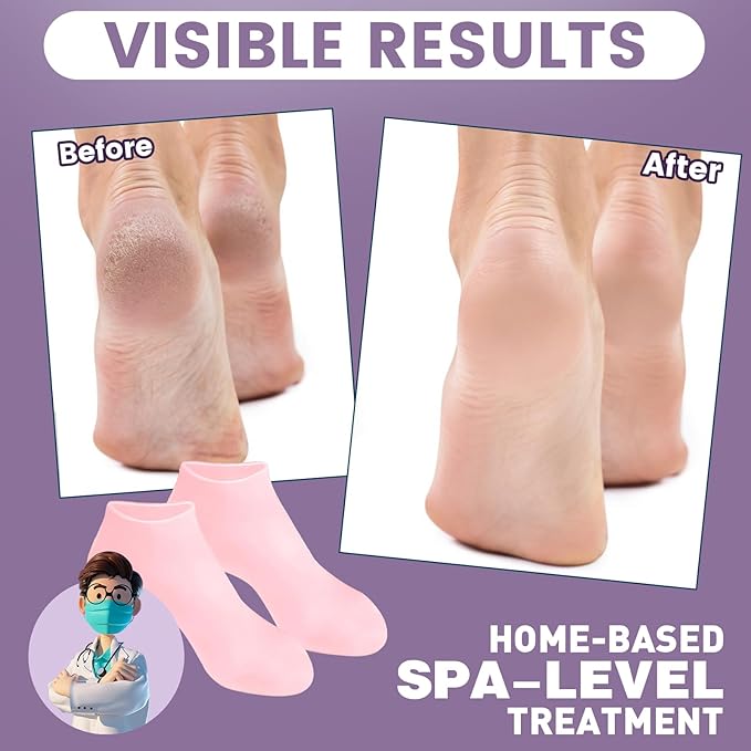 2 Pairs Silicone Socks for Dry Cracked Feet, Women's Foot Socks for Moisturizing (2 Colors Assorted, Fits Up to Size 11)
