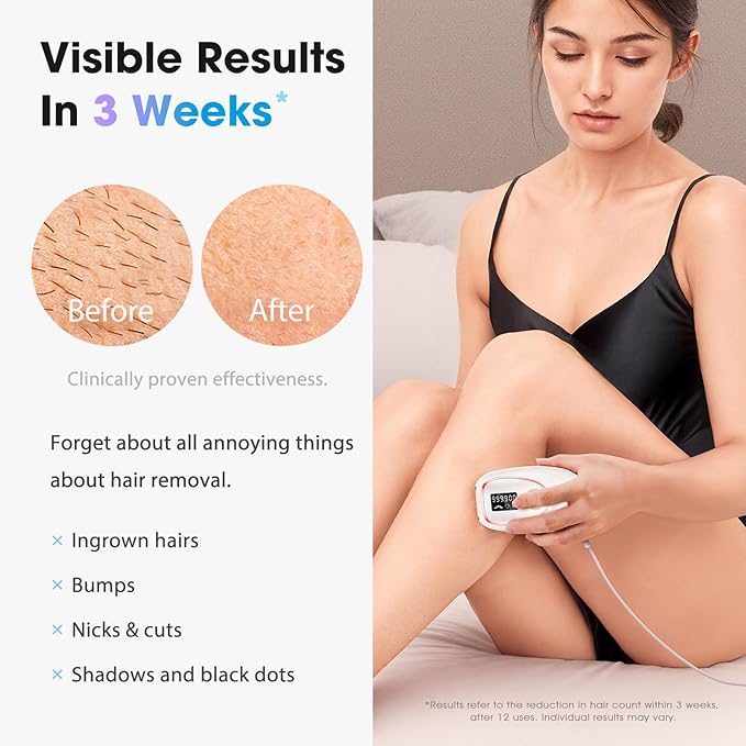 Laser Hair Removal Device, at-Home IPL Hair Removal for Women & Men - Safe 45°F Ice-Cooling Contact for Painless & Long-Lasting Results 86% Hair Reduction in 3 Weeks for Full Body, Pure White