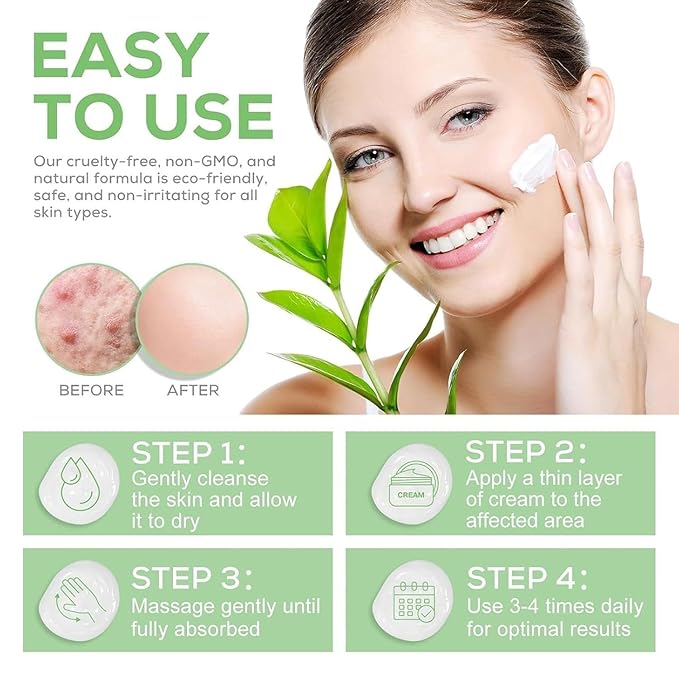 Urea Cream 40 Percent Plus 2% Salicylic Acid, 40% Urea Cream Suitable for Rough and Cracked Skin on Heels Ankles and Knees Deeply Moisturize Exfoliate Soften and Loosen Dry Callused Skin-4.23 Oz(120g)