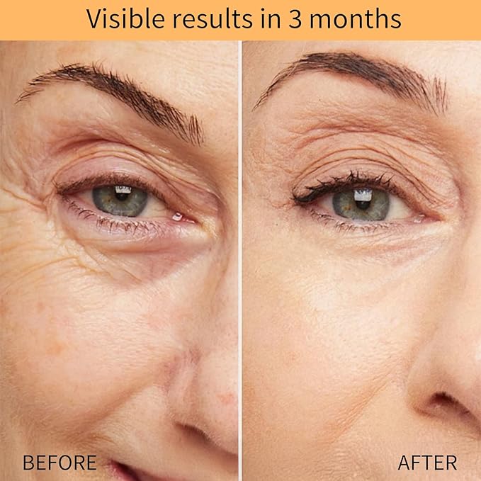 QINGLIN Polypeptide Tightening Anti-Wrinkle Cream, Firming and Smoothing Face Moisturizer， Lift & Hydrate Full Face for Youthful Skin