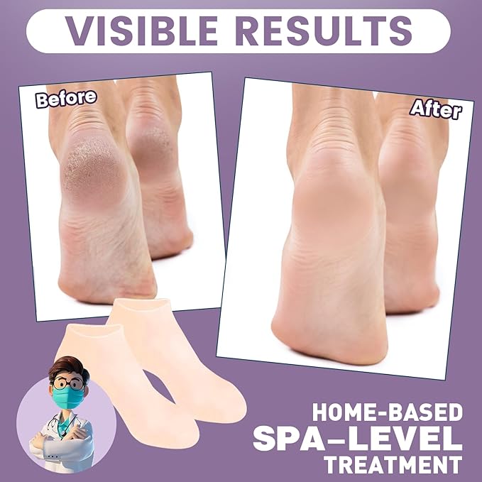 5 Pairs Silicone Socks for Dry Cracked Feet, Women's Foot Socks for Moisturizing (Beige, Fits Up to Size 11)
