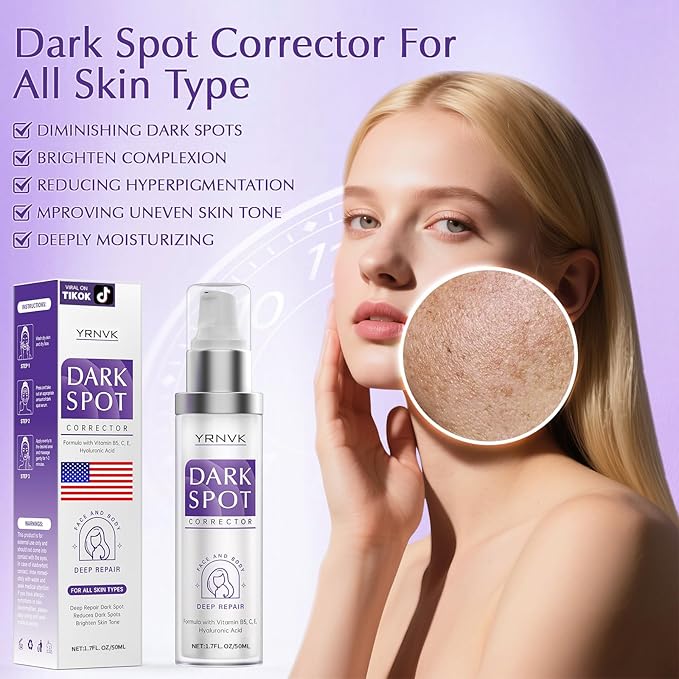 Dark Spot Remover for Face and Body, Dark Spot Corrector, Rapid Tone Repair Retinol Cream, Melasma Treatment with Vitamin C, Upgraded Skin Care Cream for Women Men
