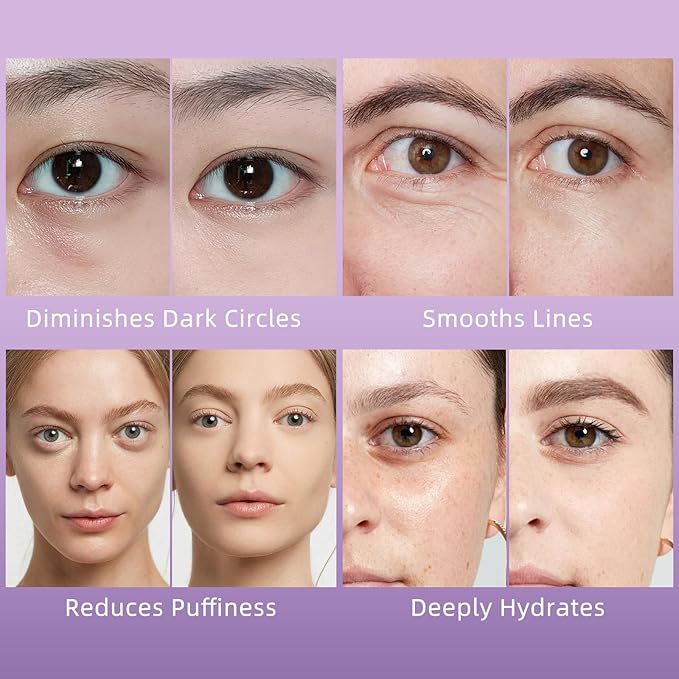 YAFUSIPE Caffeine Eye Serum for Puffy Dark Circles, Instant Depuffing Under Eye Treatment Anti-Aging Firming Undereye Serum with Roller for Wrinkles Bags Fine Lines Brightening Christmas 0.5 Floz