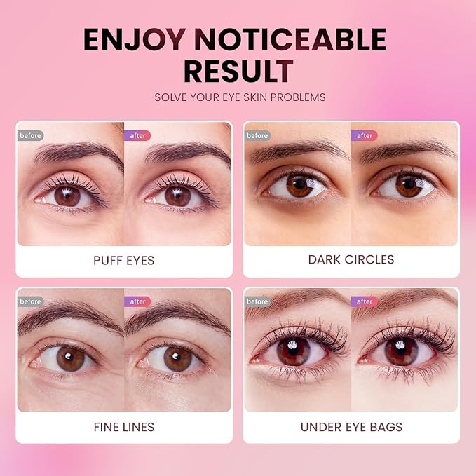 AILEORY Under Eye Patches (24 Pairs) - Tri-color Glitter Eye Gel Pads for Dark Circles, Puffy Eyes, Under eye Bags, Wrinkles | Natural Collagen Under Eye Mask Patches, Valentines Day Gift for Her