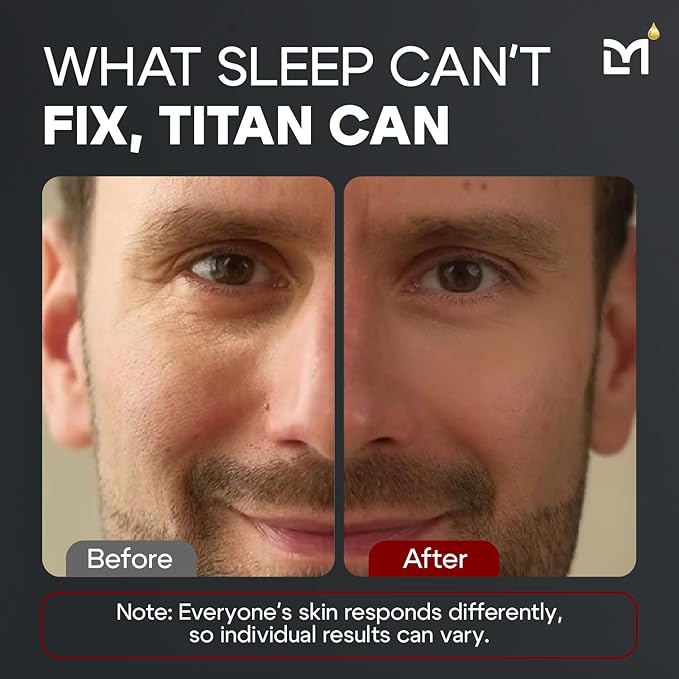 Man Labs Titan Anti-Aging Mens Eye Cream – Mens Dark Circles Under Eyes Treatment – Eye Bags Treatment for Men – Puffy Eyes Treatments for Men – Peptides, HA, Herbal Extracts –All Skin Types–Unscented
