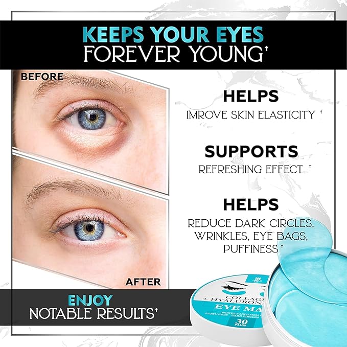 Under Eye Patches for Puffy Eyes, Dark Circles, Dull Skin - Natural Moisturizing Support - Help with Wrinkles and Fine Lines - Under Eye Mask with Hyaluronic Acid, Collagen, Caffeine - 30 Pairs