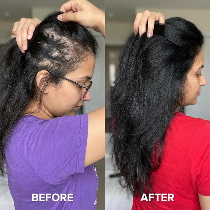 Scalp Oil, Hair serum,Botanical Blend Rosemary Hair Growth Oil with Castor Oil and Vitamin E for Thicker-Looking Hair, Plant-Based, Vegan