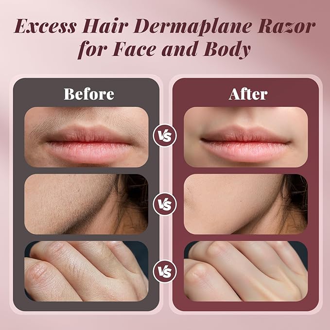 Dermaplane Razor for Women Face, BNU Facial Hair Remover for Anti-Aging - Rechargeable - LED Light - Sonic Edges - 3 Speeds, Ergonomic Handle Face Dermaplaning Tool 10 Weeks, Pink