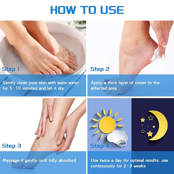 Urea Cream 40 percent for Feet Maximum Strength + 2% Salicylic Acid, Exfoliating Dead Skin & Soften Crack Foot for Extremely Dry Skin Body Lotion, Urea 40% Cream Enriched Skin Moisturizer, 5.3 oz（40%）