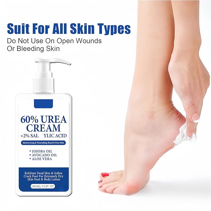 60% Urea Foot Cream – Large Size Foot & Heel Moisturizer with Jojoba Oil, Avocado Oil & Aloe Vera – Foot Lotion for Dry Cracked Feet, Hands & Elbows – 150ML/5.3oz Pump Bottle
