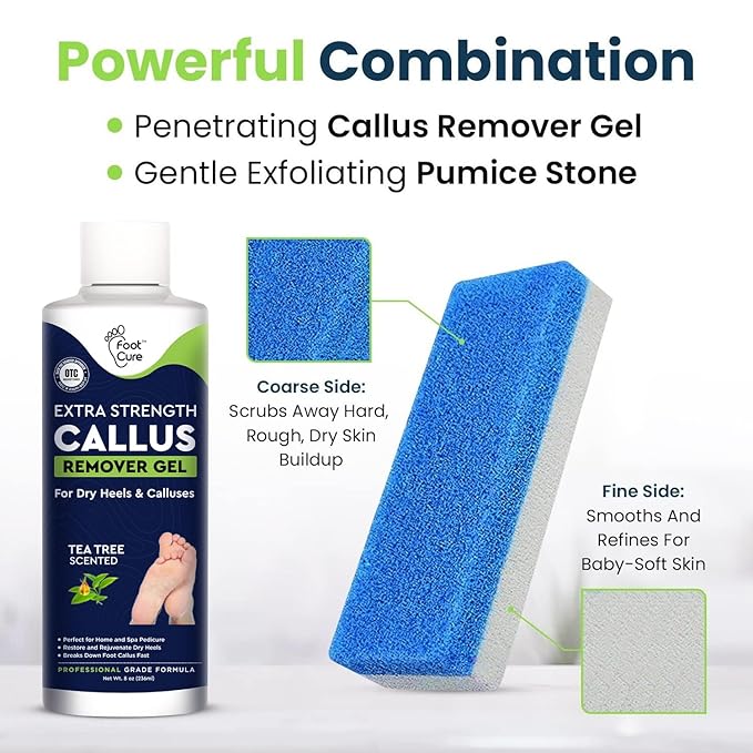 Callus Remover for Feet with Extra Strength Gel & Foot Pumice Stone Set - Easy Way to Remove Hard Calluses & Dead Skin Build-Up - Professional At-Home Foot Care for Men & Women - Made in the USA