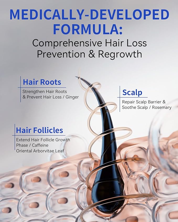 Hair Growth Serum Roll On 50ml | Hair Growth Serum 3% Rosemary Extract + Caffeine + Niacinamide + Biotin | With Ginger & Aloe Vera | No-Rinse, Fast-Absorbing | For Thinning Hair & All Hair Types