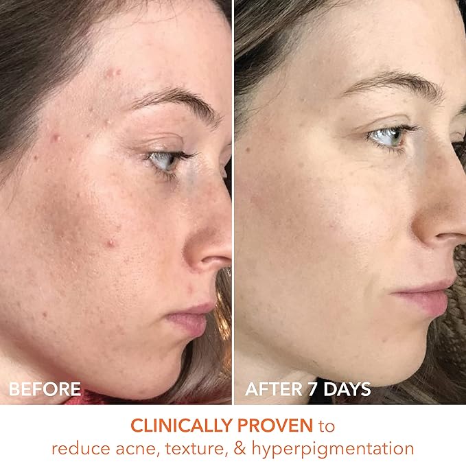 Alpha Beta Universal Daily Peel by Dr. Dennis Gross for Unisex - 60 Pc Pads