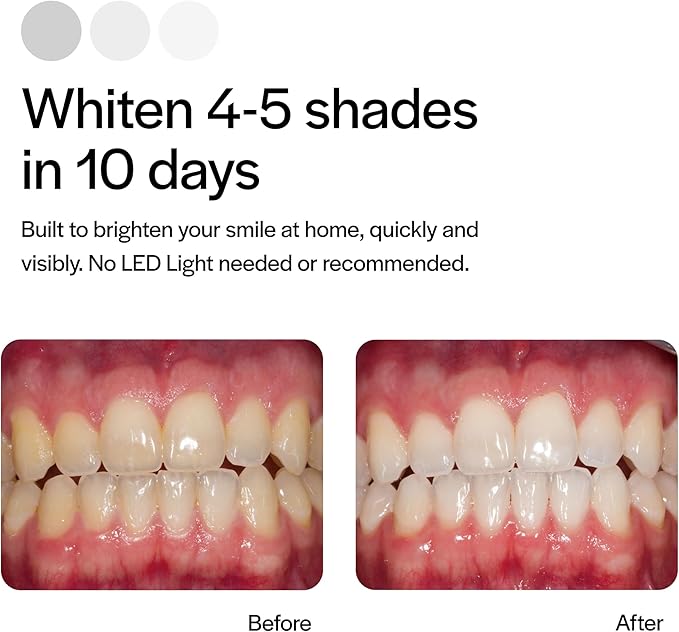 Opalescence GO 15 Whitening Bundle - (7 Treatments) Hydrogen Peroxide Prefilled Teeth Whitening Trays and Travel Original Whitening Toothpaste 1 Oz - Mint Flavor - 6238-1