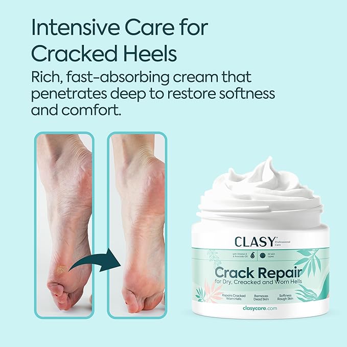 Foot Moisturizing Cream – Hydrating Heel & Foot Cream with Vitamin E and Avocado Oil – Softens Dry, Rough Skin – Nourishing Daily Foot Care, 100 ml