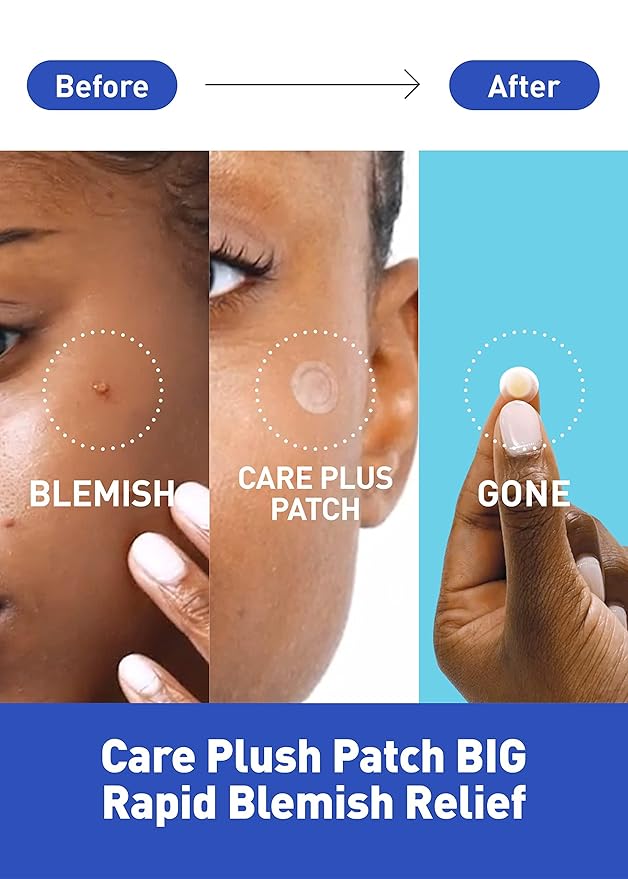 OLIVE YOUNG Care Plus Spot Patch | Hydrocolloid Acne Korean Spot Patch to Cover Zits, Pimples and Blemishes, for Troubled Skin and Face (Hydrocolloid, 102 Count (Pack of 1))