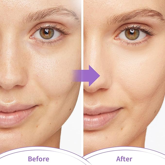 CONBELLA Cold Face Eye Masks Ice Face Mask Hot Cold Compress For Dark Circles, Puffiness, Migraines, Headache, Stress, Redness, Cooling Face Masks For Women Man, Skin Care