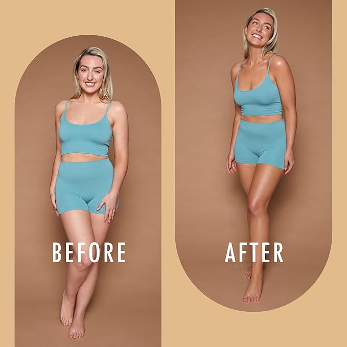 St Moriz Advanced Colour Correcting Tanning Mousse in Medium | With Hyaluronic Acid, Vitamin B5 & Advanced Skin Care Benefits | Neutralises Red Tones | Fast-Drying Vegan Fake Tan Mousse | 200ml