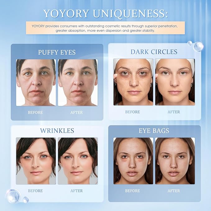 YOYORY Under Eye Patches Masks - for Dark Circles, Puffy Eyes, Fine Lines, Wrinkles, Eye Bags Treatment with Collagen and Hyaluronic Acid,Firming & Cooling, Moisturizing and Hydrating (60 Pcs) Blue