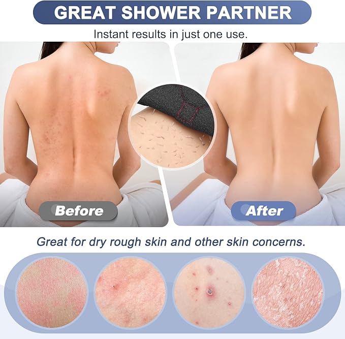 Exfoliating back scrubber with handles,