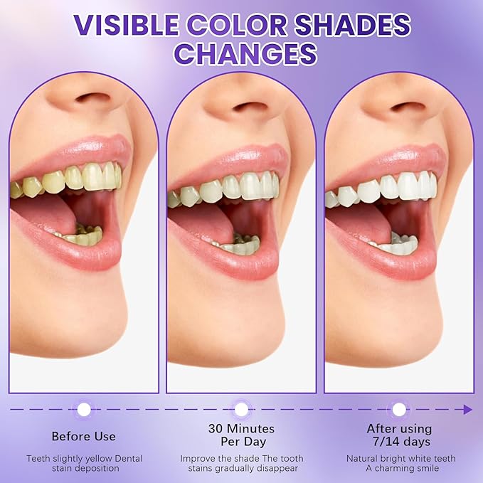 Purple Teeth Whitening Strips, Enamel Safe for Sensitive Tooth, Professional Treatments Coffee & Smoking Deep Stain Power Removal, Residue-Free Non-Slip (14Pcs)