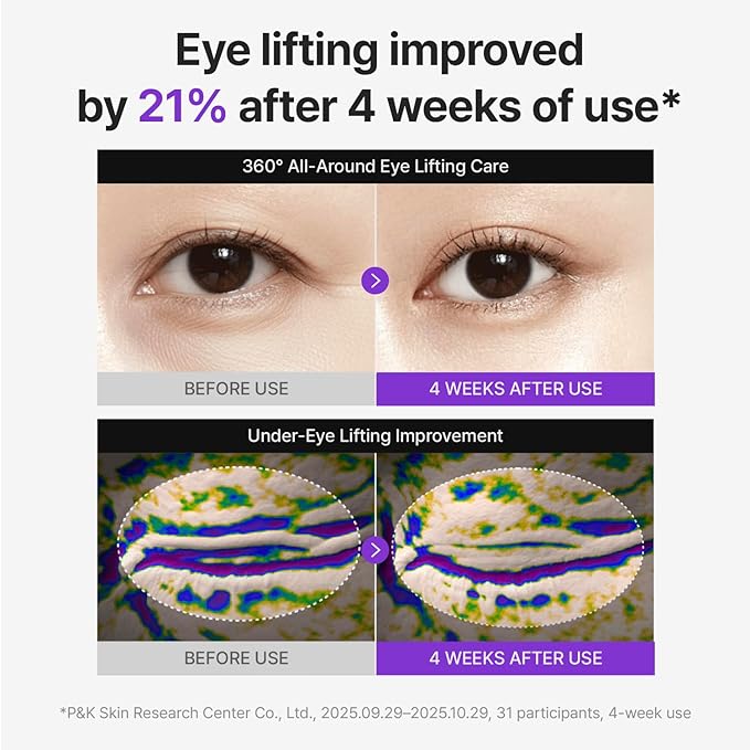 CENTELLIAN 24 360 Shot PDRN Lifting Eye Cream 30ml (1.01 fl oz) – Anti-Aging Retinol Eye Cream for Hooded Eyes, Eyelid Lifting, Wrinkle Smoothing, Firming Under-Eye Bags, Crow’s Feet & Dark Circles