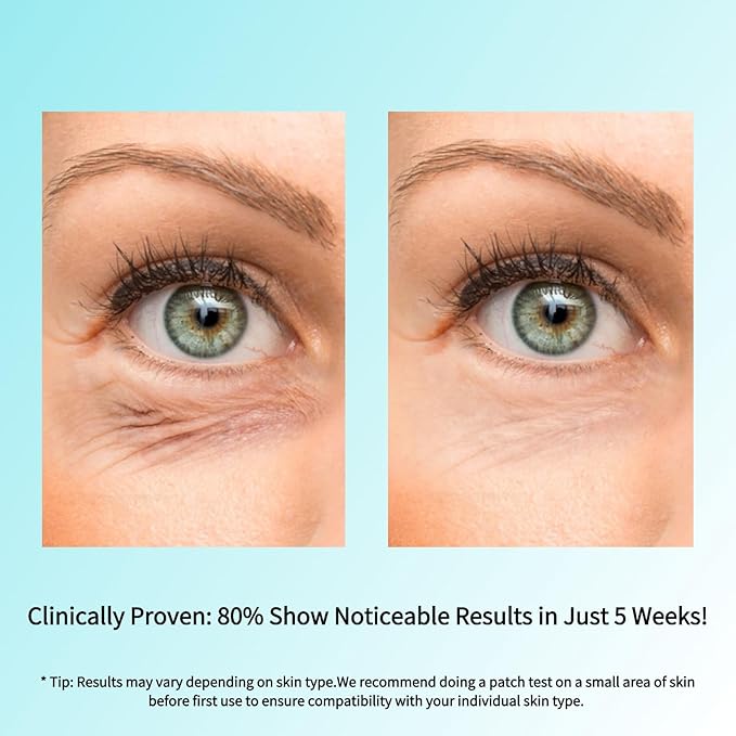 SEACALL Retinol Eye Cream with Caffeine & Vitamin C - Anti-Aging Eye Serum Treatment for Dark Circles, Wrinkles & Puffiness - Fragrance-Free, No Preservatives (15ml)