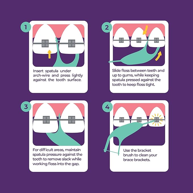 Platypus Orthodontic Flossers for Braces, 40 Count (Pack of 1), Ortho Picks for Adults & Kids, Fits Under Arch Wire, Non-Damaging, Encourage Flossing Habits