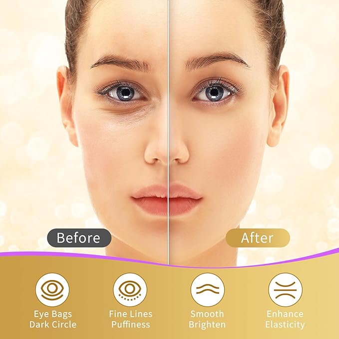 USTELIR Under Eye Patches, 40 Pairs Eye Mask for Dark Circles, Puffy Eyes, Undereye Bags,Wrinkles,Eye Mask Patches with 24K Gold, Eye Treatment Skin Care for Men & Women Gift